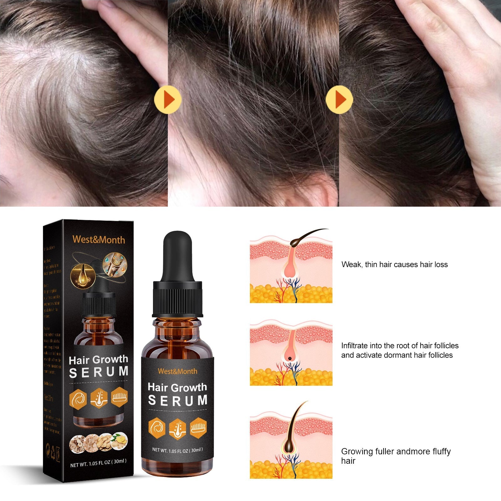 30ml Hair Growth Essence for Strong, Thick Hair Care - Happily Living