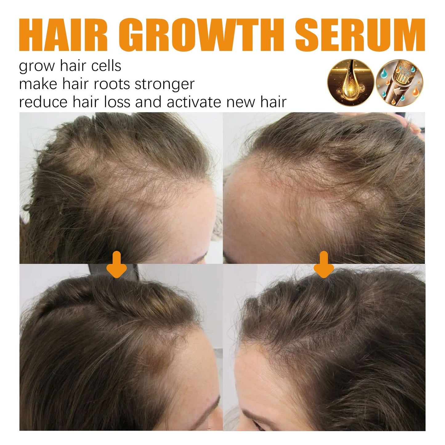 30ml Hair Growth Essence for Strong, Thick Hair Care - Happily Living