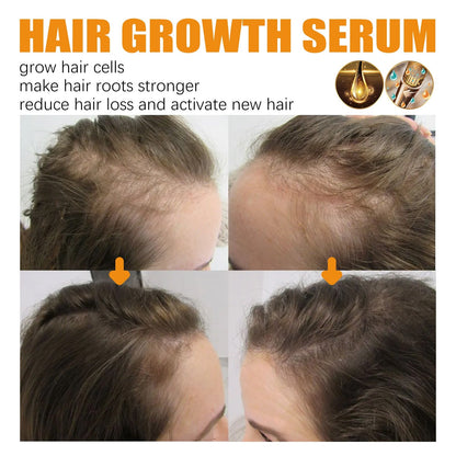 30ml Hair Growth Essence for Strong, Thick Hair Care - Happily Living