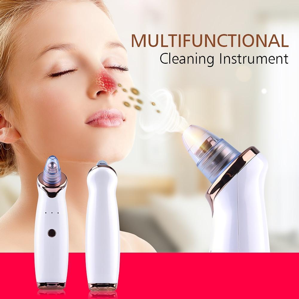 Electric Blackhead Remover Vacuum - Happily Living