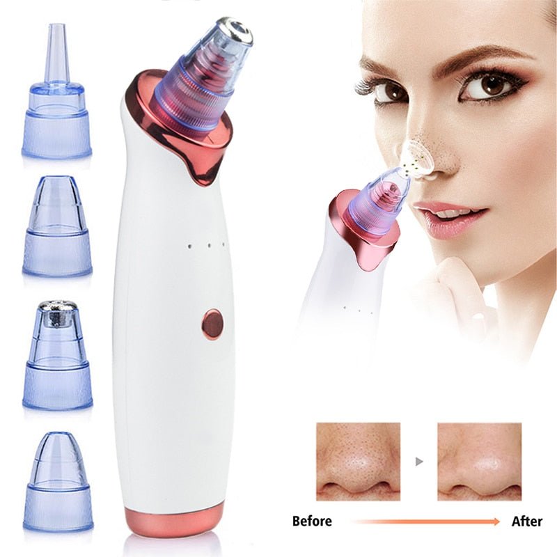 Electric Blackhead Remover Vacuum - Happily Living