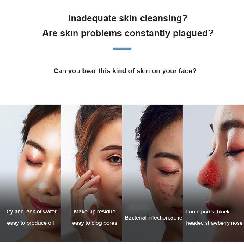 Electric Blackhead Vacuum Remover - Happily Living