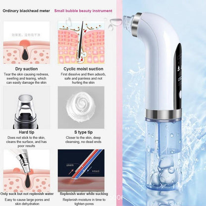 Electric Blackhead Vacuum Remover - Happily Living